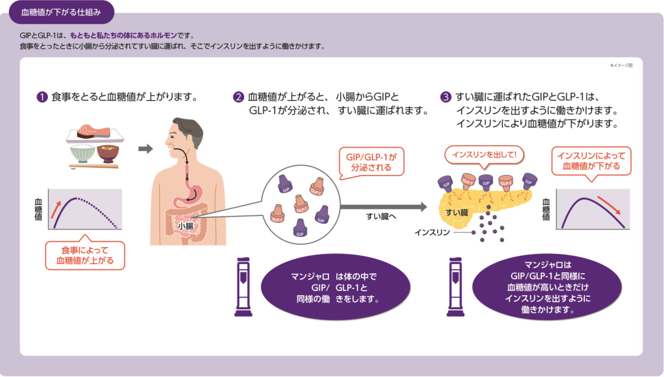 GLP-1 ダイエット注射は、インスリン注射ではありません